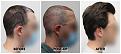 Click image for larger version

Name:	Right-Forum.jpg
Views:	234
Size:	93.5 KB
ID:	502075