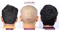 Click image for larger version

Name:	Slide6.jpg
Views:	191
Size:	94.8 KB
ID:	502096