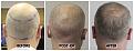Click image for larger version

Name:	Donor-Forum.jpg
Views:	218
Size:	98.6 KB
ID:	502110