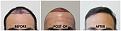 Click image for larger version

Name:	Hairline-Forum.jpg
Views:	585
Size:	99.9 KB
ID:	502127
