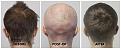 Click image for larger version

Name:	Donor-Forum.jpg
Views:	236
Size:	96.9 KB
ID:	502138