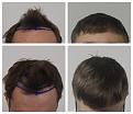 Click image for larger version

Name:	Hairline-45D-Forum.jpg
Views:	237
Size:	80.6 KB
ID:	502139