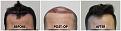 Click image for larger version

Name:	Hairline-Forum.jpg
Views:	210
Size:	101.4 KB
ID:	502182