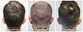 Click image for larger version

Name:	Donor-Forum.jpg
Views:	201
Size:	100.3 KB
ID:	502184