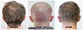Click image for larger version

Name:	Donor-Forum.jpg
Views:	234
Size:	102.2 KB
ID:	502221
