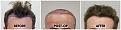 Click image for larger version

Name:	Hairline-Forum.jpg
Views:	227
Size:	103.9 KB
ID:	502222