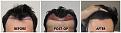 Click image for larger version

Name:	Hairline-Forum.jpg
Views:	308
Size:	101.9 KB
ID:	502249