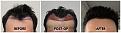Click image for larger version

Name:	Hairline2-Forum.jpg
Views:	307
Size:	103.8 KB
ID:	502250