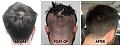 Click image for larger version

Name:	Donor-Forum.jpg
Views:	250
Size:	100.5 KB
ID:	502253