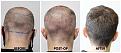 Click image for larger version

Name:	Donor-Forum.jpg
Views:	216
Size:	95.7 KB
ID:	502291