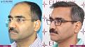 Click image for larger version

Name:	hair-transplant-before-after-6.jpg
Views:	422
Size:	20.0 KB
ID:	502311