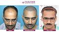Click image for larger version

Name:	hair-transplant-before-after-8.jpg
Views:	403
Size:	20.1 KB
ID:	502313