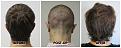 Click image for larger version

Name:	Donor-Forum.jpg
Views:	640
Size:	100.8 KB
ID:	502360