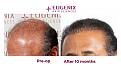 Click image for larger version

Name:	Slide3.jpg
Views:	312
Size:	93.4 KB
ID:	502434
