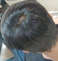 Click image for larger version

Name:	IMG_20190410_185827.jpg
Views:	230
Size:	95.8 KB
ID:	503116