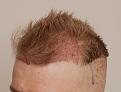 Click image for larger version

Name:	drdfue (8).jpg
Views:	157
Size:	64.5 KB
ID:	536436