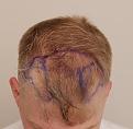 Click image for larger version

Name:	drdfue (3).jpg
Views:	152
Size:	72.3 KB
ID:	536441