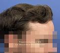 Click image for larger version

Name:	Post2small.jpg
Views:	0
Size:	80.8 KB
ID:	538336