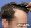 Click image for larger version

Name:	Post6small.jpg
Views:	0
Size:	76.3 KB
ID:	538340