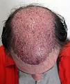 Top down view immediately after a 3733 FUT