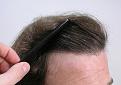 HAIRLINE CLOSEUP