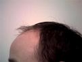 GetAttachment 5.aspx