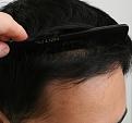 View of new frontal coverage