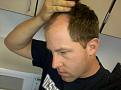 The hairline is now there