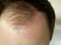 hair pulled to the side