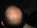 IMG 4563