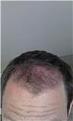 defined lines on a conservative hairline