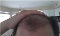 almost 2900 grafts still coming in.
