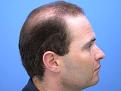 Right Profile