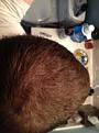 hair