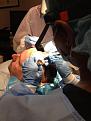 Having grafts implanted