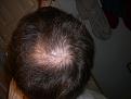 same day under different lighting conditions (flash I think).
It looked to me that my "thin spot" was becoming more and more like a Bald spot.