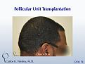 A 35-year-old African-American male underwent a 2200 FU session with Dr. Carlos K. Wesley (NYC).