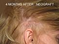 After 4 months