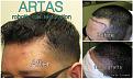 1hair2 MAY2015