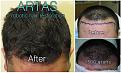 hair2 MAY2015