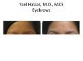 eyebrows before and after
