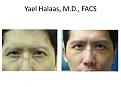 eyebrows before and after