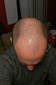 Top of Head