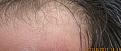 New Hairs 4 months