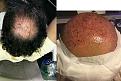 before treatment