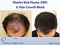 CARLOS K. WESLEY, MD (NYC)
Ph (844) 745-6362
INFO@DRCARLOSWESLEY.COM