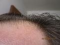 IMG 8105