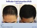 CARLOS K. WESLEY, MD (NYC)
Ph (844) 745-6362
INFO@DRCARLOSWESLEY.COM