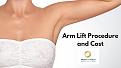 Looking for Arm lift surgery removes saggy skin and red rapes the remaining skin, giving it a tighter and smoother appearance. Well, you are on the right place at Dr. Biraj A Naithani. We are providing the best arm lift at lowest cost. Do get in touch with us at +971 2 6335556 http://plasticasurgery.org/procedure/arm-lift/
