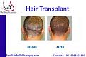 hairtransplantsurgery